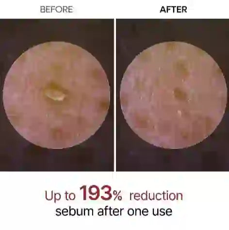 Radiant Rice Peeling Ampoule before and after use showing up to 193% sebum reduction. Exfoliating glow ampoule visibly clears and smooths skin.